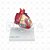 Modelo Patológico Do Coração Com Hipertrofia Em 2 Partes - Imagem 2