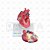 Modelo Patológico Do Coração Com Hipertrofia Em 2 Partes - Imagem 1