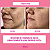 Gel Secativo  Acne Defense 15g - Ricca - Imagem 4