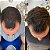 2 Tônicos Para Crescimento Roganic Hair Growth 120ml Tróia Hair - Imagem 5