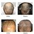 2x Foligain Minoxidil 5% Tratamento Capilar Masculino 6 Meses – 360ml - Imagem 3