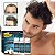 Minoxidil 5%, Kit 3 Frascos de 60ml, 3 meses East Moon - Imagem 2