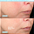 NuFACE NuFACE Effective Lip & Eye Attachment - Imagem 2