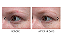 Dr. DENNIS GROSS SKINCARE Hyaluronic Marine Dew It Right Eye Gel - Imagem 3