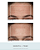 NUFACE Trinity Facial Toning Device + Wrinkle Reducer Attachment Bundle - Imagem 2