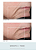 NUFACE Trinity Facial Toning Device + Wrinkle Reducer Attachment Bundle - Imagem 3