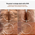 LYMA Laser Starter Kit - Imagem 4