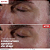 Erborian Skin Therapy Eye Cream - Imagem 6