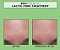 PETER THOMAS ROTH PRO Strength Lactic Pore Treatment - Imagem 2