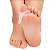 Corretivo para Joanete Skingel 3 em 1 Sg118 Ortho Pauher - Imagem 2