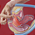 Disco Menstrual Yuper - Imagem 4