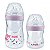 KIT MAMADEIRAS NUK ESSENCE CONTROLE TEMPERATURA SMART FLOW 150/270ml ROSA - Imagem 2