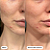 Hero Cosmetics Mighty Patch Invisible, Daytime Hydrocolloid Acne Pimple Patch - Imagem 3