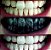 Clareador Dental Carvão Ativado Dentes Muito Mais Brancos - Imagem 2