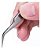 2 Pinças Extensão Cilios Fio A Fio Volume Russo + Bubble Pad - Imagem 4