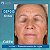Harmonização Facial sem Agulhas com Cellfie 2%, Oligo Ha 0,3%, Lanablue  5% e Ácido hialuronico 3% 30g - Imagem 2