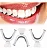 Moldeira para Clareamento Dental - Imagem 2