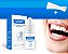 Gel Dental Clareador e Removedor de Manchas - Imagem 3