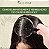 Tônico Melaleuca 120ml | Para dermatites, psoríase, oleosidade e inflamação | Salunat - Imagem 2