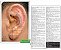 Mapa Auricular Prof. Thiago Nishida - Auriculoterapia - Imagem 1