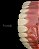 Resina 3D Horus Denture - DLP e LCD - Imagem 6