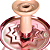 Narguile Completo Trinto Zip - Rose (Black Friday) - Imagem 2