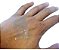 2 Rolos de Fita Cirúrgica De Silicone Adesiva Rolo 2,5cm x 1,5 metro (Cicatriz ) - Vital Derme - Imagem 5