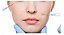 Microcânula Preenchimento Facial 25g X 50mm Caixa C/ 10unidades - Fabinject - Imagem 2