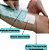 Curativo Opsite Post-Op Com Compressa Absorvente 30cm x 10cm Unidade - Smith & Nephew - Imagem 3