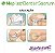 Curativo Mepilex Border Sacrum 22x25cm Unidade - Molnlycke - Imagem 3
