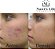 Kit Rejuvenescimento Facial Nawts Life Limpeza Profunda - Imagem 3
