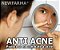 ANTI ACNE  (Poderoso no combate a acne) - 30 Gr - Imagem 1