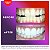 Kit de clareamento dental Colgate Optic White ComfortFit com luz LED e caneta clareadora, seguro para o esmalte, compatível com iPhone e Android - Imagem 3
