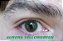 KSSEYES AURORA ANUAL/PAR - Imagem 8