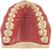 Manequim Dentística Superior (cod.101SUP) - Imagem 2