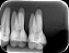 Manequim Cirurgia Parendodontica cod.411 - Imagem 5