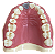 Manequim Dentística superior preparo para faceta (cod.103N) - Imagem 1