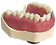 Manequim Dentística superior preparo para faceta (cod.103N) - Imagem 2