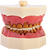 Manequim Cirurgia com dentes de Perio (cod.315) - Imagem 1
