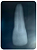 MINI KIT DENTES ENDO ( DENTE: 21, 24 E 26 POLPADOS RADIOPACOS) - Imagem 4