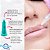 AGULHA LEBEL 32G - 4MM CX C/ 100 UNID - Imagem 4