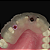 Resina 3D Odontológica PrintaX DD Guide Biocompatível 500g - Imagem 3