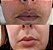 Sérum Facial AHAs Ácido Glicólico 10% + Ácido Tranexâmico 1% + Ácido Lactobiônico 0,5% + Ácido Málico 0,5% - Imagem 4