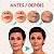 Adesivos Anti Rugas para Rosto Modelo:16 Peças (Rosto-16) - Imagem 10