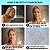 Adesivos Anti Rugas para Rosto Modelo:9 Peças (Rosto-9) - Imagem 4