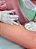 Curso Presencial: PEIM - Procedimento Estético Injetável para Microvasos - (18 e 19 de Janeiro de 2025 em RECIFE/PE) - Imagem 7