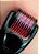 Curso Presencial: Microagulhamento (Dermaroller + Dermapen) - (08 e 09 de Março de 2025 em RECIFE/PE) - Imagem 1