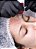 Curso Presencial: Microagulhamento (Dermaroller + Dermapen) - (08 e 09 de Março de 2025 em RECIFE/PE) - Imagem 4