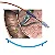 Prótese/Stent Biliar Plástico 10Fr 150mm Curvado de Amsterdã com Sistema Introdutor - Imagem 3