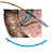Prótese/Stent Biliar Plástico 8,5Fr 150mm Curvado de Amsterdã com Sistema Introdutor - Imagem 3